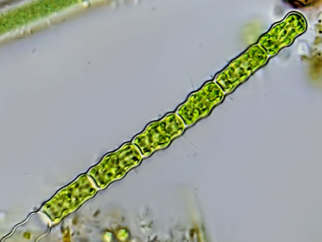 Leben im Teich Haematococcus sp.(Chlorophyta)